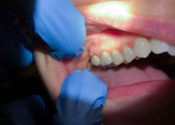 Best Cosmetic Emergency Dentistry in Milan, MO
